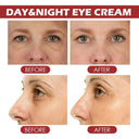 EELHOE Retinol Eye Stick for Puffiness