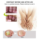 EFERO Nail Fungus Repair Serum Combat Infections Nourish Nails