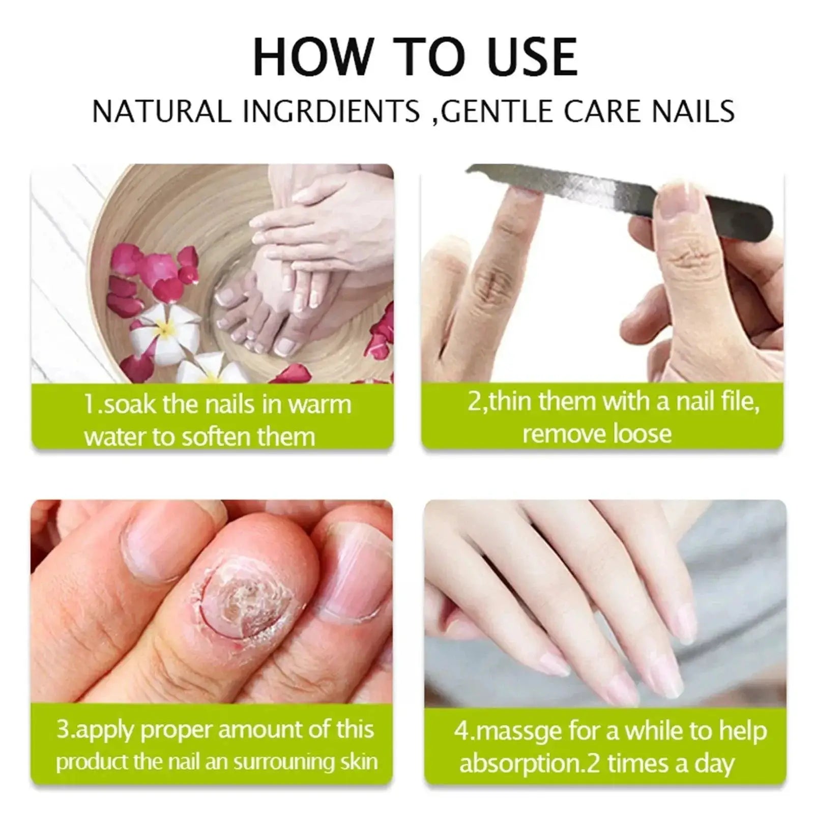 EFERO Nail Fungus Repair Serum Nourish Nails And Infections