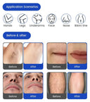 Efficient Hair and Tattoo Removal Device