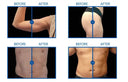 EMS Body Slimming Machine for Home Use