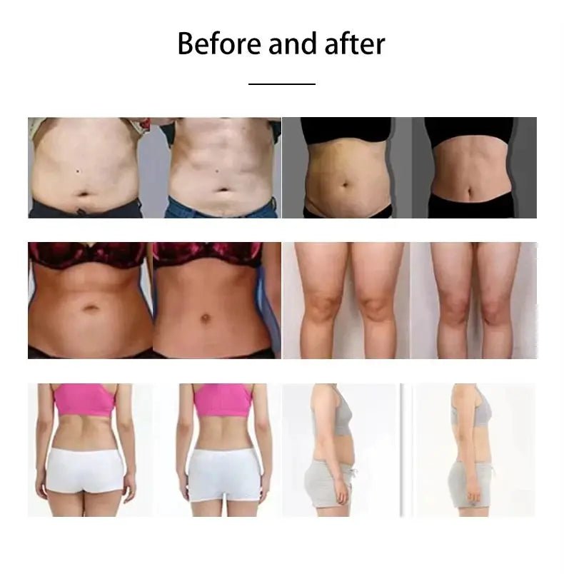 Emsnova 2 In 1 Body Shaping Machine For Home Use Muscle Stimulation Fat Loss