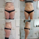Fat Burning RF Body Shaping Device Home