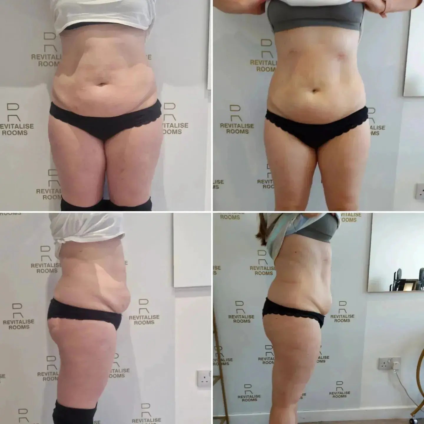 EMSZERO HIEMT RF Body Shaping Machine Fast Muscle Growth and Fat Burning