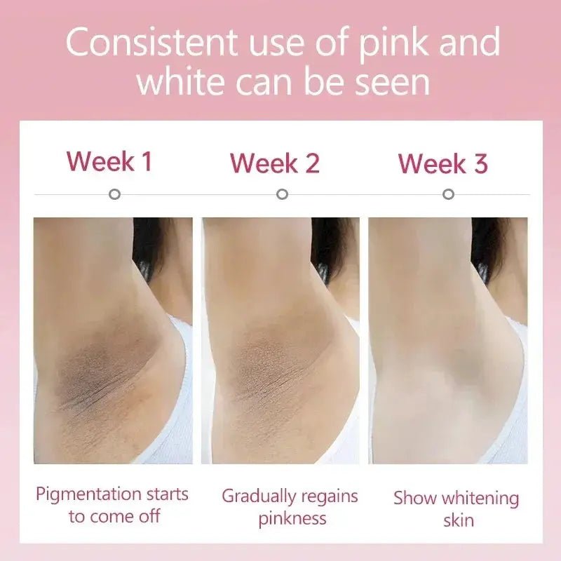 Even Tone Whitening Cream for Underarms