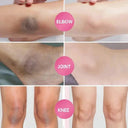 Even Tone Whitening Cream for Underarms
