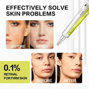 Eye Cream for Women Wrinkle Reduction