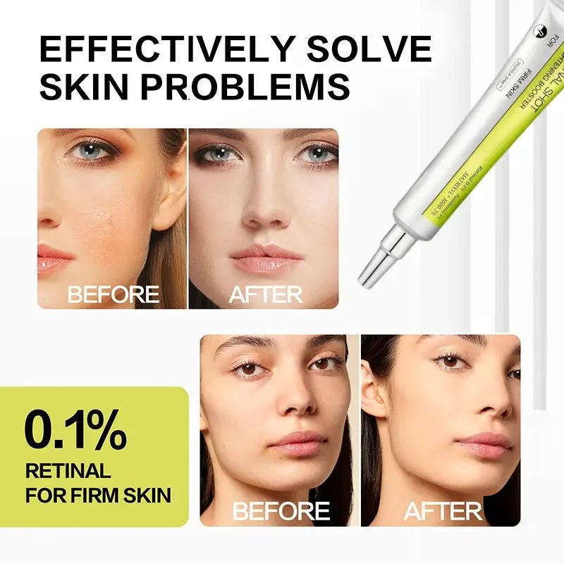 Eye Cream for Women Wrinkle Reduction