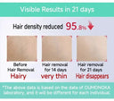 Fast Results IPL Hair Removal for Women
