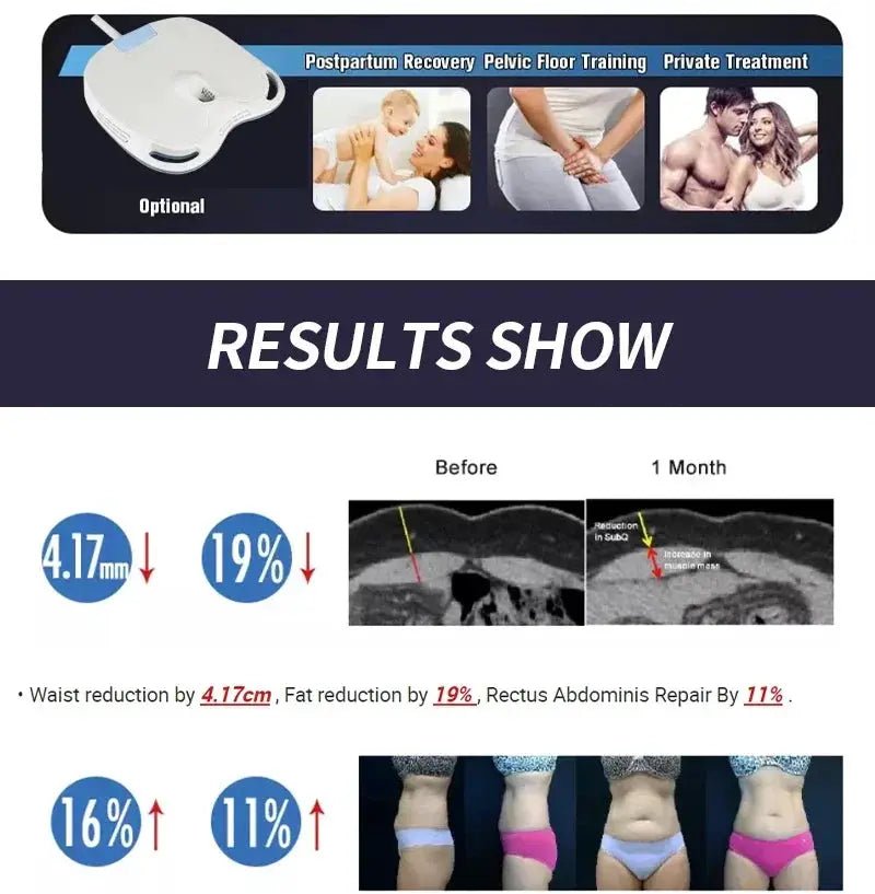 Fat Burning RF Body Shaping Device Home — product view 20