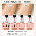 Gentle IPL Hair Removal Device for Home