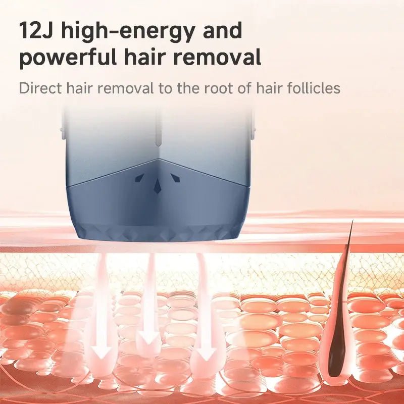Gentle IPL Hair Removal Device for Home