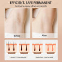 Gentle IPL Hair Removal Device for Home