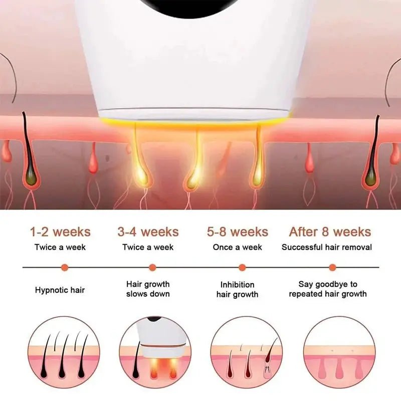 Gentle IPL Hair Removal Device for Home