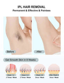 Gentle IPL Hair Removal Device for Home