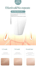 Gentle IPL Hair Removal Device for Home