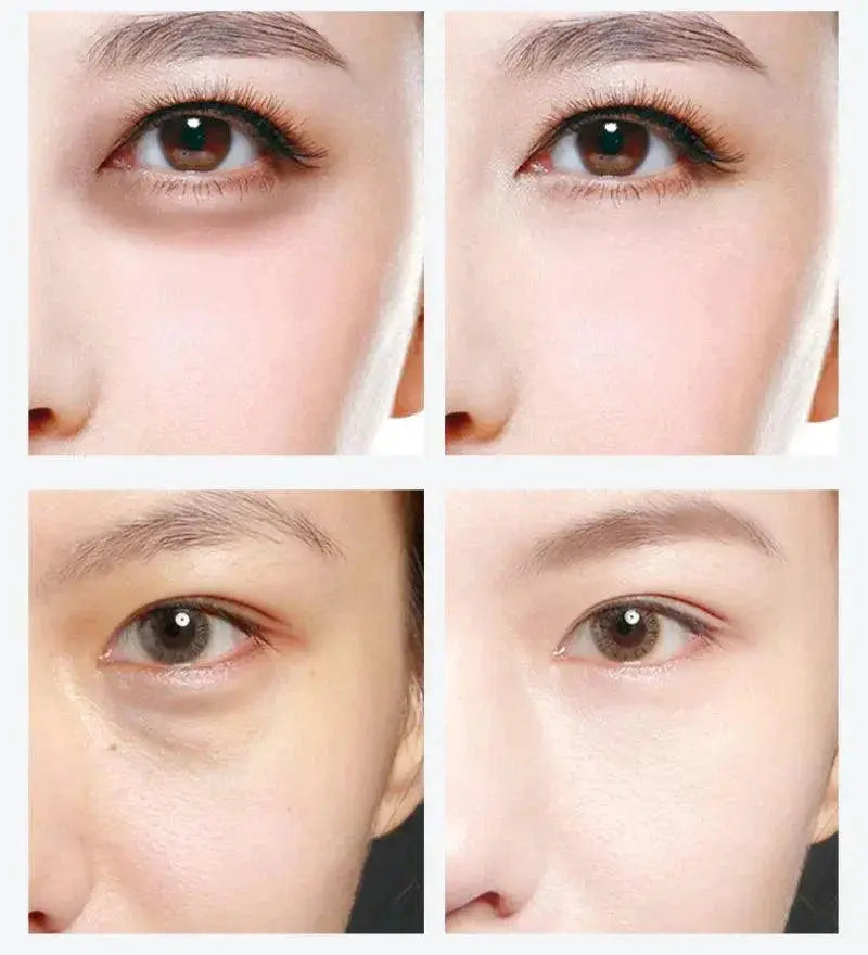 Gold Caviar Eye Masks Youthful Rejuvenation Hydration