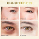 Skincare Gold Eye Mask for Brighter Eyes