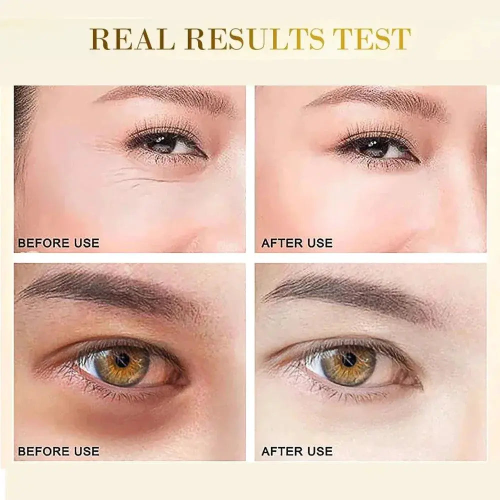Golden Hydration Eye Mask Brightens Eyes And Youthful Skin