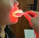 Gum Relief LED Therapy Device For Dental