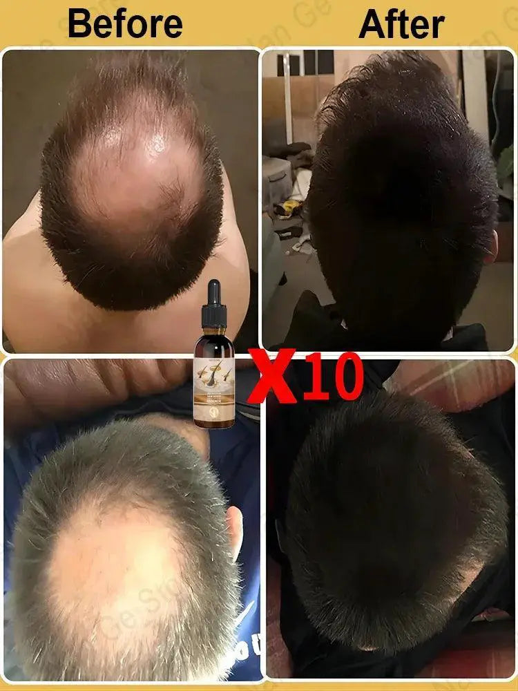 Hair Growth Oil Rapid Repair for Baldness and Hair Loss