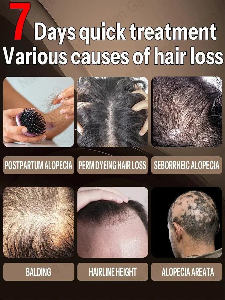 Hair Growth Oil Rapid Repair for Baldness and Hair Loss