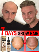 Hair Growth Oil: Rapid Repair for Baldness and Loss