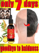Hair Growth Oil Rapidly Regrow Hair and Combat Baldness