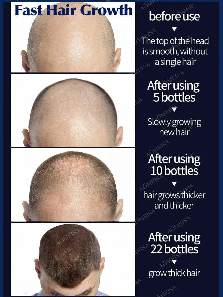 Hair Growth Oil Rapid Hair Regrowth And Baldness Solution