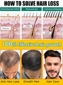 Hair Growth Oil Rapidly Regrow Hair and Combat Baldness