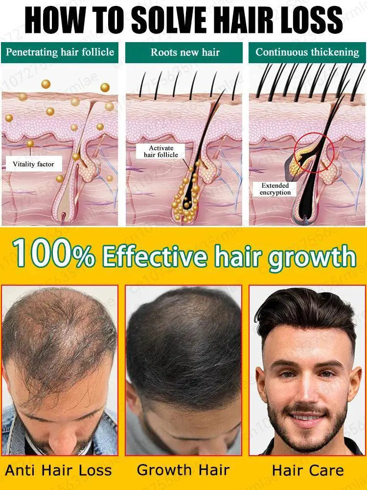 Hair Growth Oil Rapid Hair Regrowth And Baldness Solution