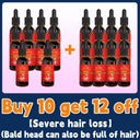 Hair Growth Oil Rapidly Regrow Hair and Combat Baldness