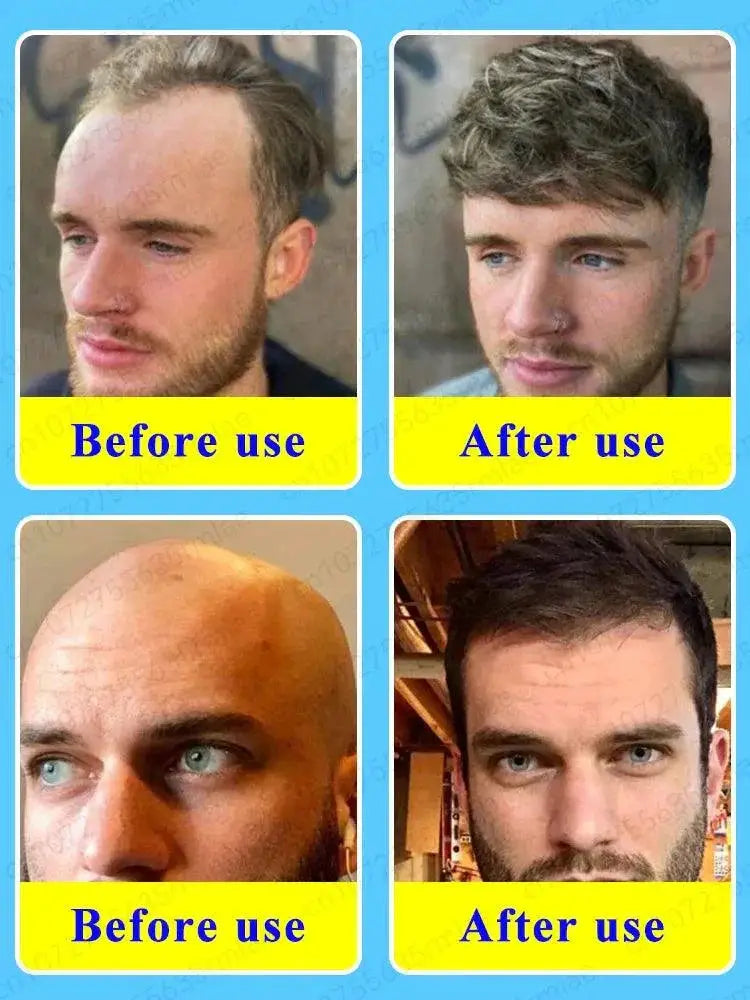Hair Growth Oil Rapid Hair Regrowth And Baldness Solution