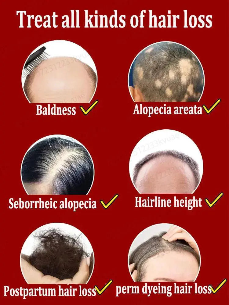 Hair Growth Oil Rapid Hair Regrowth And Baldness Solution