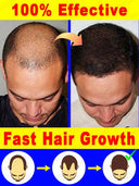Hair Growth Repair Serum for Baldness Alopecia Effective Formula