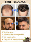 Hair Growth Repair Serum for Baldness Alopecia Effective Formula