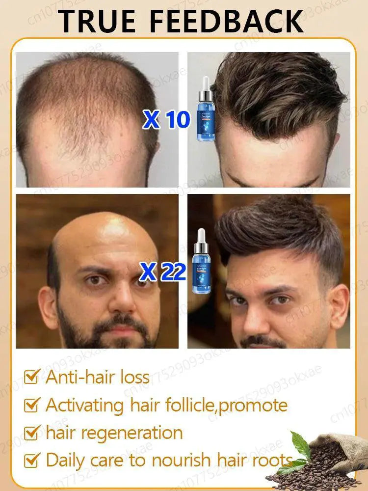 Hair Growth Repair Serum for Baldness and Alopecia - OurLum.com