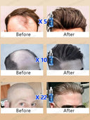 Hair Growth Repair Serum for Baldness Alopecia Effective Formula