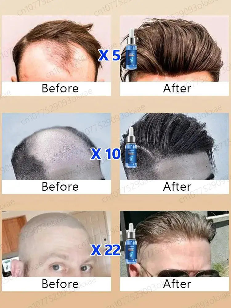 Hair Growth Repair Serum for Baldness and Alopecia - OurLum.com