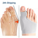 Hallux Valgus Bunion Corrector for Orthopedic Foot Support