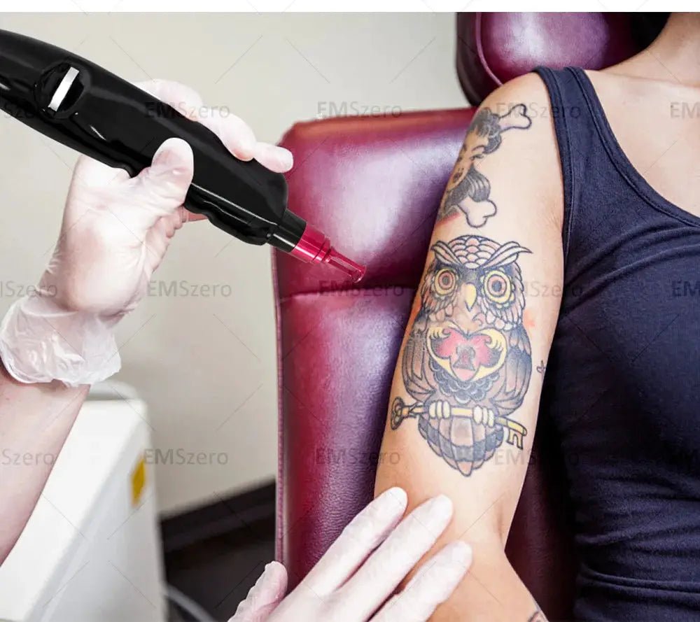 Home Hair Removal Laser for Gentle Grooming