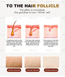 Home Hair Removal Laser for Gentle Grooming