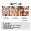 Hydrating Cream for Acne-Prone Skin