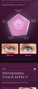 Hydrating Eye Cream For Dark Circles | Eye Cream