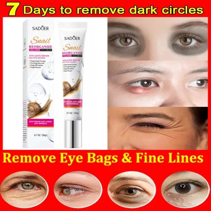 Hydrating Eye Cream For Dark Circles | Eye Cream