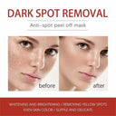 Hydrating Whitening Cream for Dark Spots