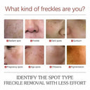 Hydrating Whitening Cream for Dark Spots