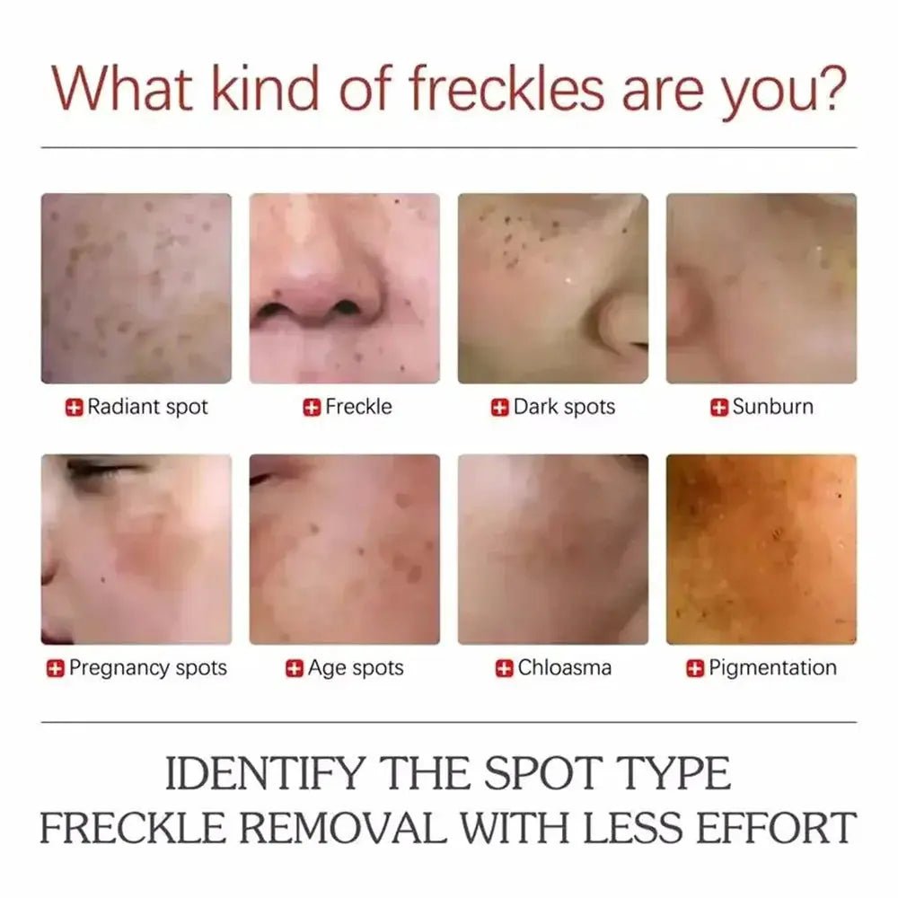 Hydrating Whitening Cream for Dark Spots — product view 9