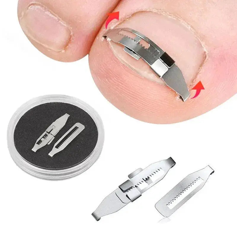 Ingrown Toenail Corrector Adjustable Gentle Care Tool