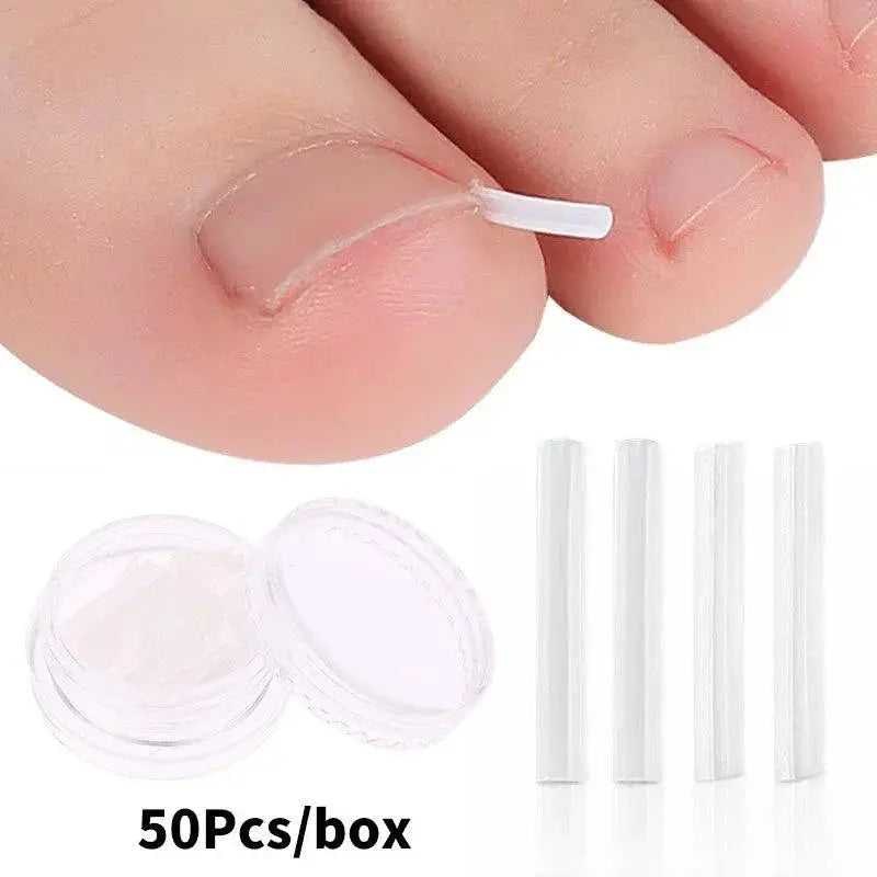 Ingrown Toenail Correction Kit For Home And Professional Use